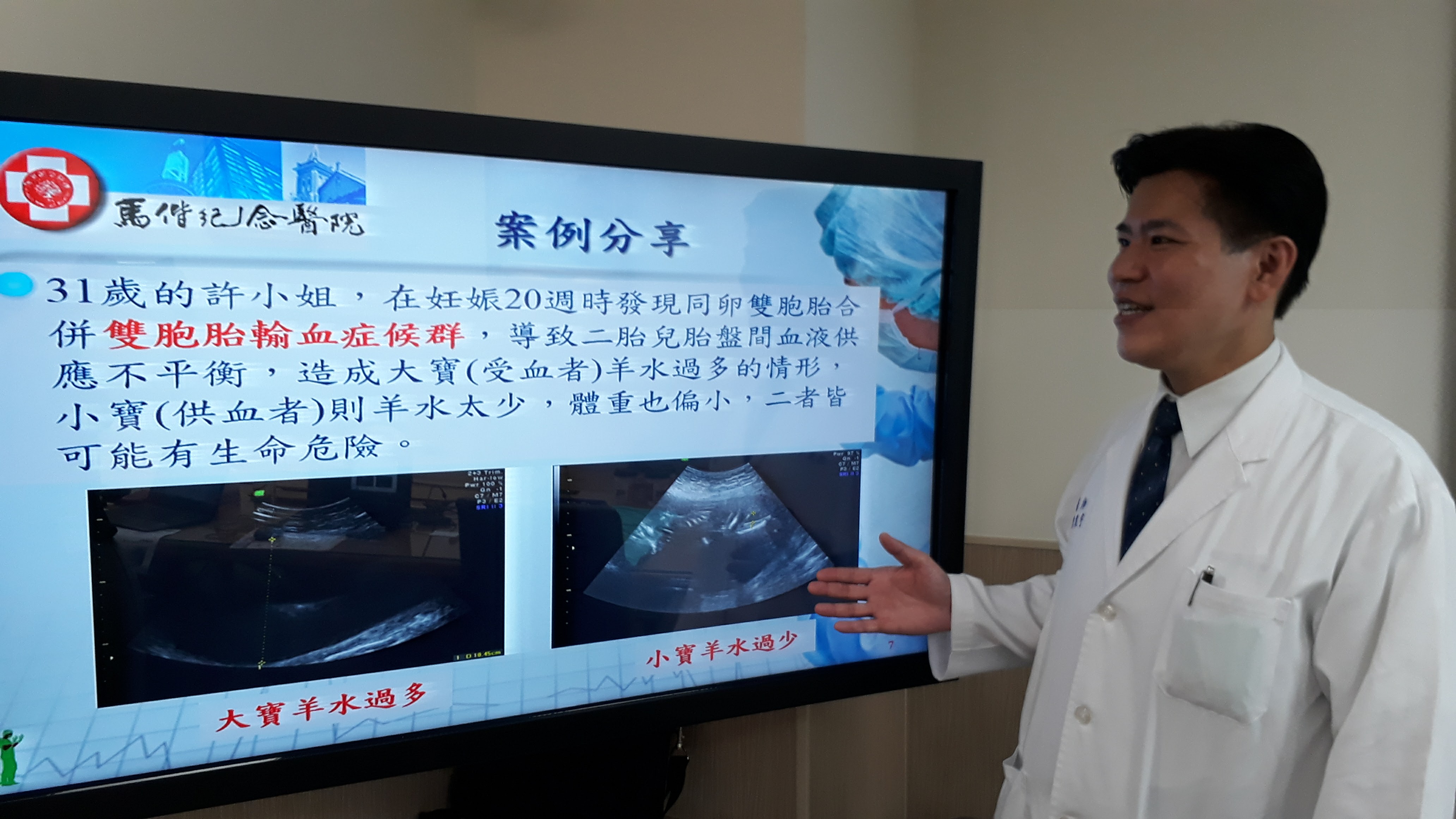給他活下去的機會！馬偕胎兒治療挽救新生命說明圖片